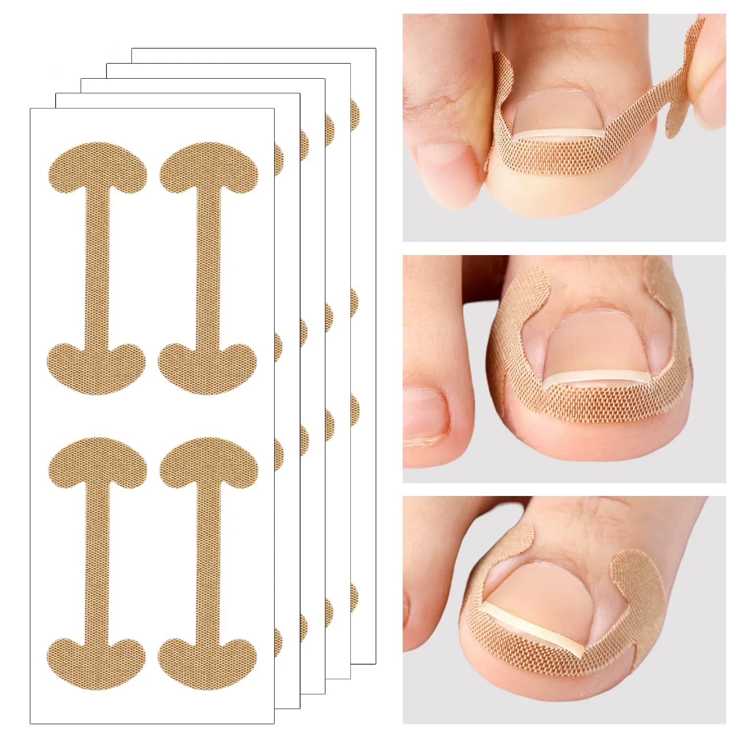 מדבקות תיקון ציפורן מקצועיות